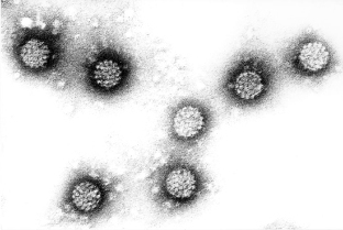 Virus papiloma manusia