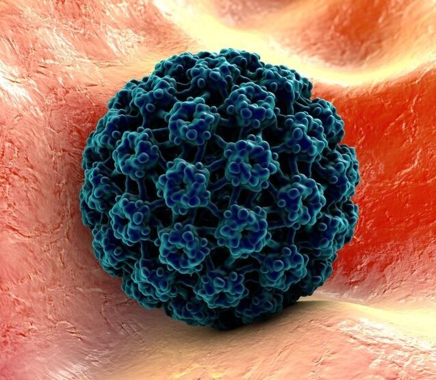 Model 3D HPV menyebabkan kutil di tangan